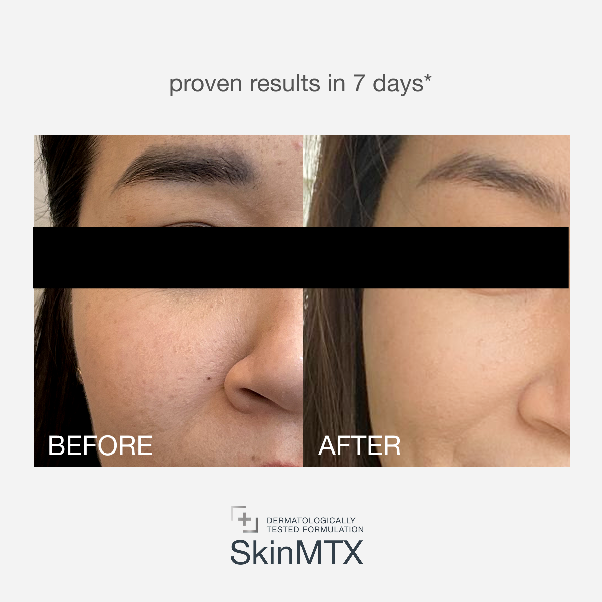 Night Resurfacing Booster+