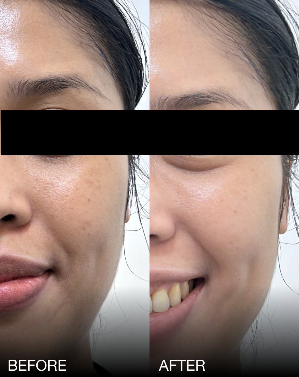 HYDRA-FIRM PDRN COLLAGEN MASK