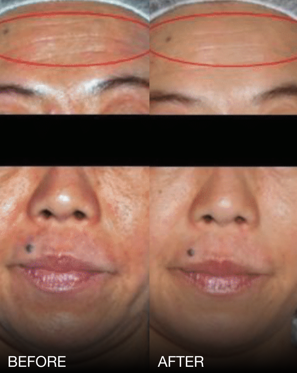 INTENSE REJUVORA™ CREAM